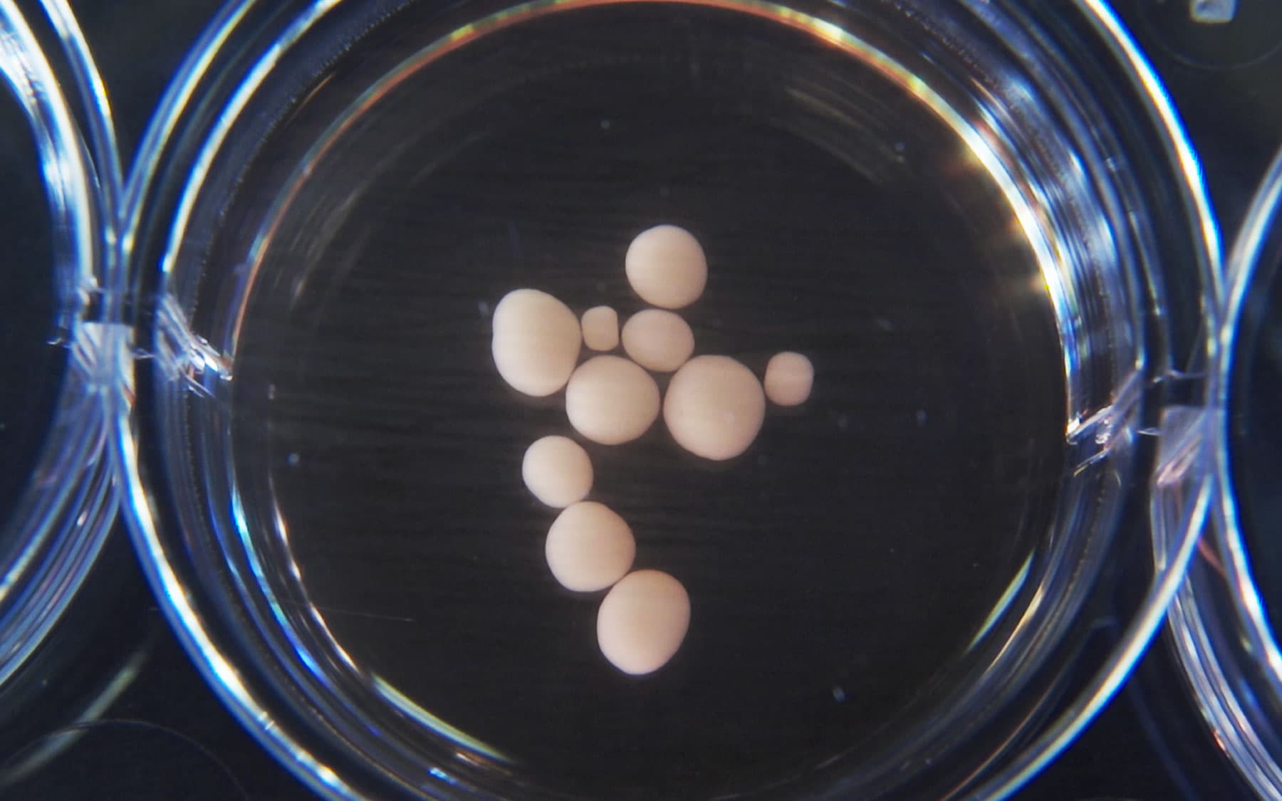 Are Brains Grown in a Dish For Technology and Research Going too Far?